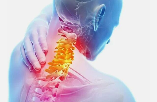 Osteohondroza cervikalne regije