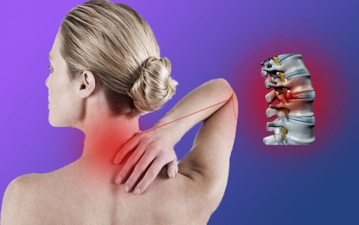 Upala kralježnice s cervikalnom osteohondrozom