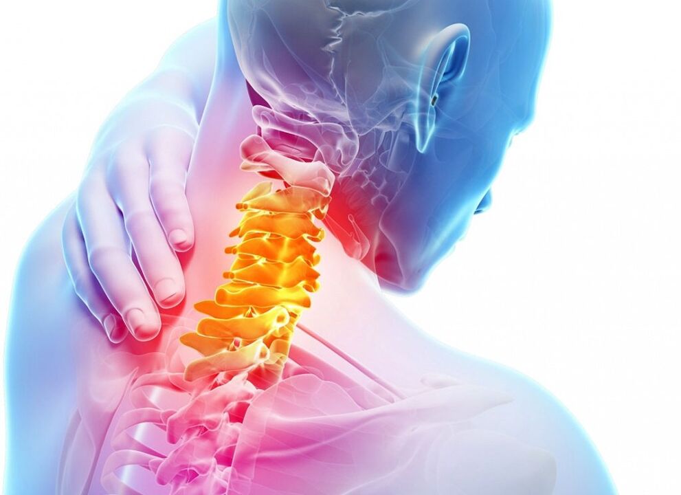 Što je osteohondroza grlića maternice