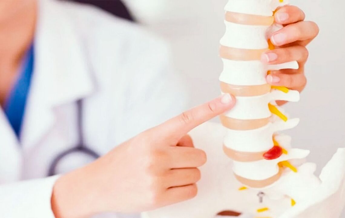 oštećenje kralježnice zbog cervikalne osteohondroze