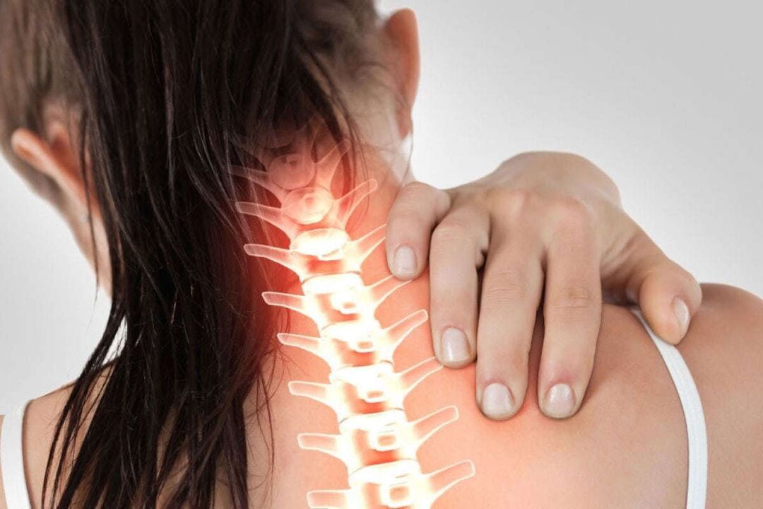 Manifestacije cervikalne osteohondroze